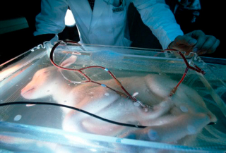 Illustration for article titled How to Build an Artificial Womb